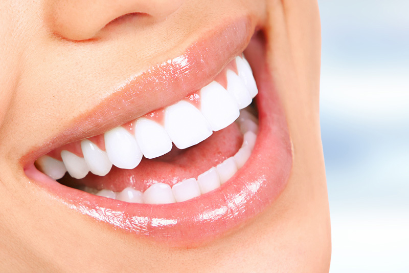 Cosmetic Dentistry in Bel Air